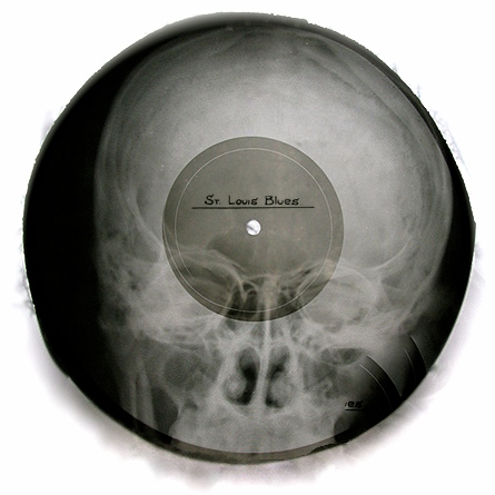 I 50'erne og 60'erne blev der distribueret ulovlige kopier af vestlig musik på gamle røntgenfotos. Foto: https://x-rayaudio.squarespace.com/stlouis